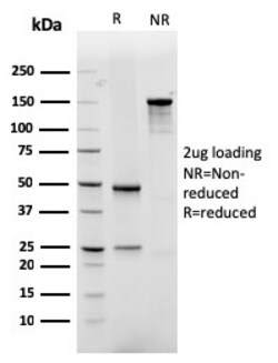 Biotium&nbsp;GLUT-1 (Tumor Progression and Mesothelioma Marker)(rGLUT1/2476), CF405S conjugate, 0.1mg/mL