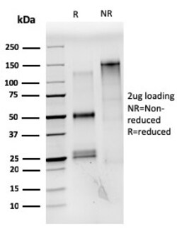 Biotium&nbsp;Estrogen Receptor, alpha (Marker of Estrogen Dependence)(ESR1/3559), CF640R conjugate, 0.1mg/mL