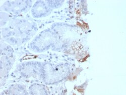 Biotium&nbsp;von Willebrand Factor / Factor VIII Related-Ag (Endothelial Marker)(rVWF/2480), CF640R conjugate, 0.1mg/mL