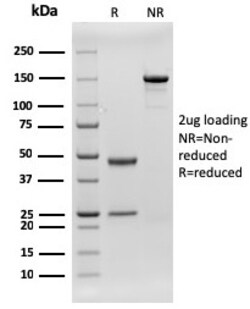 Biotium&nbsp;CD79b (B-Cell Marker)(rIGB/1842), CF640R conjugate, 0.1mg/mL