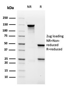 Biotium&nbsp;MALT1 (MALT-Lymphoma Marker)(rMT1/410), CF647 conjugate, 0.1mg/mL