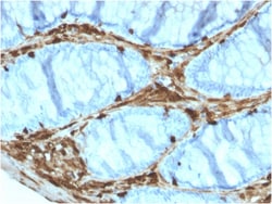 Biotium&nbsp;Annexin A1 / (Hairy Cell Leukemia Marker)(ANXA1/3566), CF640R conjugate, 0.1mg/mL
