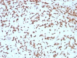 Biotium&nbsp;Cathepsin D (Tumor Marker)(CTSD/3275), Biotin conjugate, 0.1mg/mL
