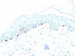 Biotium&nbsp;Tyrosinase-Related Protein-1 (TYRP-1) (Melanoma Marker)(TYRP1/3280), Biotin conjugate, 0.1mg/mL