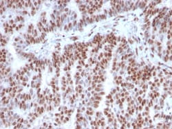 Biotium&nbsp;Estrogen Receptor, alpha (Marker of Estrogen Dependence)(ESR1/3342), 0.2mg/mL