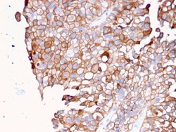Biotium&nbsp;Uroplakin 1B (Urothelial Differentiation Marker)(UPK1B/3081), 0.2mg/mL