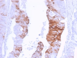 Biotium&nbsp;Cytokeratin 20 (KRT20) (Colorectal Epithelial Marker)(KRT20/3129R), 0.2mg/mL