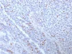 Biotium&nbsp;Estrogen Receptor, alpha (Marker of Estrogen Dependence)(ESR1/3373), 0.2mg/mL