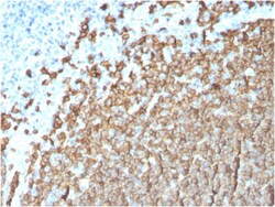 Biotium&nbsp;CD20/ MS4A1 (B-Cell Marker)(MS4A1/3411), 0.2mg/mL
