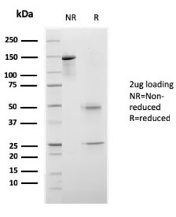 Biotium&nbsp;CELA3B / ELA3B (Pancreatic Function Marker)(rCELA3B/1811), 0.2mg/mL