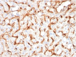 Biotium&nbsp;C1QB / Complement C1q B-Chain(C1QB/2965), 1mg/mL