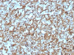 Biotium&nbsp;Spectrin beta III (SPTBN2)(SPTBN2/3142R), 0.2mg/mL