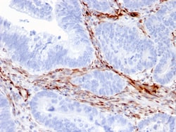 Biotium&nbsp;Nestin (Cancer Stem Cell Marker)(NES/2911), CF740 conjugate, 0.1mg/mL
