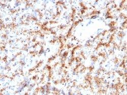 Biotium&nbsp;Cathepsin D (Tumor Marker)(CTSD/3082), 0.2mg/mL