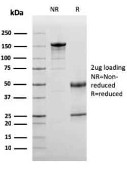 Biotium&nbsp;Complement 3d (C3d) (Acute Humoral Rejection Marker)(C3D/2891), 0.2mg/mL
