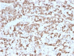 Biotium&nbsp;Prolactin (Pituitary Tumor Marker)(PRL/2910), 0.2mg/mL