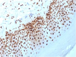 Biotium&nbsp;Nucleophosmin (Acute Myeloid Leukemia Marker)(NPM1/3398), 0.2mg/mL
