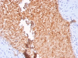 Biotium&nbsp;Fodrin / Alpha Spectrin II (SPTAN1) / NEAS(SPTAN1/3352), 0.2mg/mL
