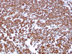 Biotium&nbsp;CD20 / MS4A1 (B-Cell Marker)(MS4A1/3409), 0.2mg/mL