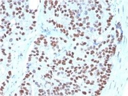 Biotium&nbsp;NKX3.1 (Metastatic Prostate Adenocarcinoma Marker)(NKX3.1/3348), 0.2mg/mL