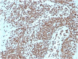 Biotium&nbsp;Nucleophosmin (Acute Myeloid Leukemia Marker)(NPM1/3287), 0.2mg/mL