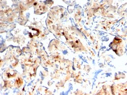 Biotium&nbsp;S100A4 / Metastasin / Calvasculin (Marker of Tumor Metastasis)(rS100A4/1481), 1mg/mL