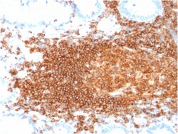 Biotium&nbsp;CD45RB (B-Cell Marker)(rPTPRC/1132), 1mg/mL