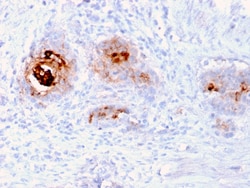 Biotium&nbsp;TAG-72 / CA72.4 (Tumor-Associated Glycoprotein)(rB72.3), 1mg/mL