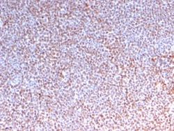 Biotium&nbsp;ALK (Anaplastic Lymphoma Kinase) / CD246(ALK/3218R), 0.2mg/mL