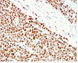 Biotium&nbsp;MSH6 (DNA Mismatch Repair Protein)(MSH6/3086), 1mg/mL