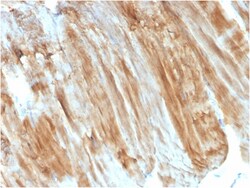 Biotium&nbsp;Dystrophin (DMD) (Marker of Duchenne and Becker Muscular Dystrophy)(DMD/3243), 0.2mg/mL
