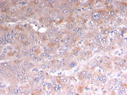 Biotium&nbsp;Adipophilin / Perilipin-2 (Marker of Lipid Accumulation)(rADFP/1493), 1mg/mL