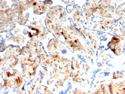 Biotium&nbsp;S100A4 / Metastasin / Calvasculin (Marker of Tumor Metastasis)(rS100A4/1481), 0.2mg/mL