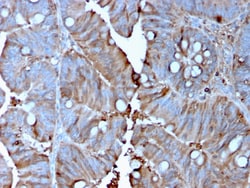 Biotium&nbsp;MerTK (Innate Immune Checkpoint)(MERTK/3015), CF640R conjugate, 0.1mg/mL