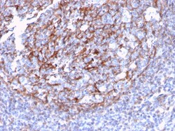 Biotium&nbsp;CD21 (Mature B-Cell & Follicular Dendritic Cell Marker)(CR2/3124R), CF640R conjugate, 0.1mg/mL