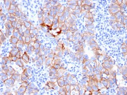 Biotium&nbsp;HER-2 / c-erbB-2 / neu / CD340(ERBB2/3080), CF640R conjugate, 0.1mg/mL
