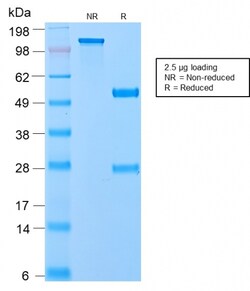 Biotium&nbsp;VLDL-Receptor (Very Low Density Lipoprotein Receptor)(VLDLR/2896R), CF594 conjugate, 0.1mg/mL