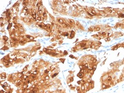 Biotium&nbsp;Uroplakin 1A (Urothelial Differentiation Marker)(UPK1A/2922), CF740 conjugate, 0.1mg/mL