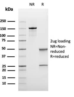 Biotium&nbsp;Bcl-6 (Follicular Lymphoma Marker)(rBCL6/1475), CF488A conjugate, 0.1mg/mL