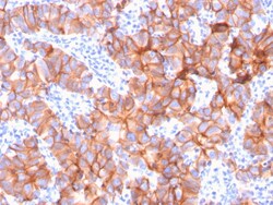 Biotium&nbsp;HER-2 / c-erbB-2 / neu / CD340(ERBB2/3079), CF640R conjugate, 0.1mg/mL