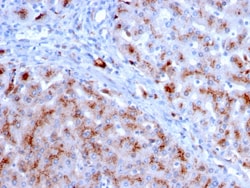Biotium&nbsp;Cathepsin D (Tumor Marker)(CTSD/3083), CF640R conjugate, 0.1mg/mL