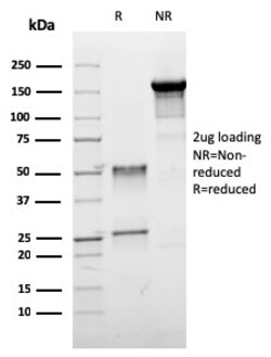 Biotium&nbsp;ER-beta-1 (Estrogen Receptor beta-1)(ESR2/3005), CF568 conjugate, 0.1mg/mL