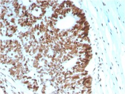 Biotium&nbsp;MSH6 (DNA Mismatch Repair Protein)(MSH6/2927), CF594 conjugate, 0.1mg/mL