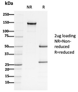 Biotium&nbsp;APC / Adenomatous Polyposis Coli / FAP (Tumor Suppressor)(ALi 12-28), CF405S conjugate, 0.1mg/mL