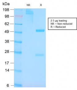 Biotium&nbsp;p53 Tumor Suppressor Protein(TP53/3156R), CF640R conjugate, 0.1mg/mL