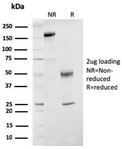 Biotium&nbsp;ER-beta-1 (Estrogen Receptor beta-1)(ESR2/3207), CF640R conjugate, 0.1mg/mL