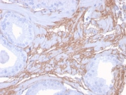 Biotium&nbsp;Decorin(DCN/3523), CF640R conjugate, 0.1mg/mL
