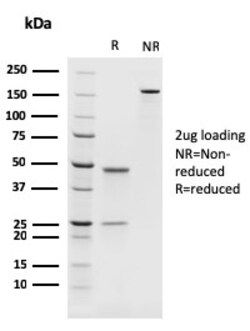 Biotium&nbsp;PAX8 (Renal Cell Marker)(rPAX8/1492), CF647 conjugate, 0.1mg/mL