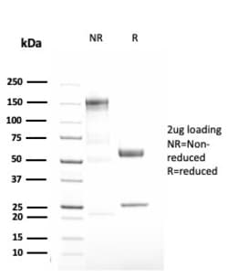 Biotium&nbsp;Alpha-1-Antitrypsin (SERPINA1) (Hepatocellular & Histiocytic Marker)(AAT/3167R), CF640R conjugate, 0.1mg/mL