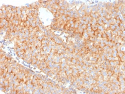 Biotium&nbsp;PAI-RBP1 / SERBP1 / SERPINE1(SERBP1/3491), CF640R conjugate, 0.1mg/mL